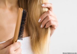 Causes For Hair Loss in Women - Do You Know the Causes of Hair Loss?