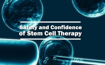 Safety and Confidence of Stem Cell Therapy